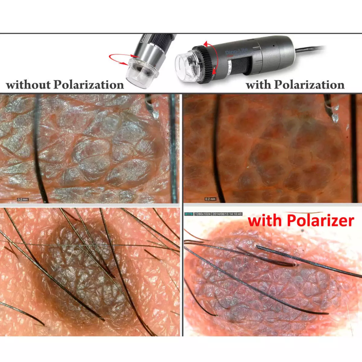 Dino-Lite DermaScope Polarizer Wireless Videodermatoskop