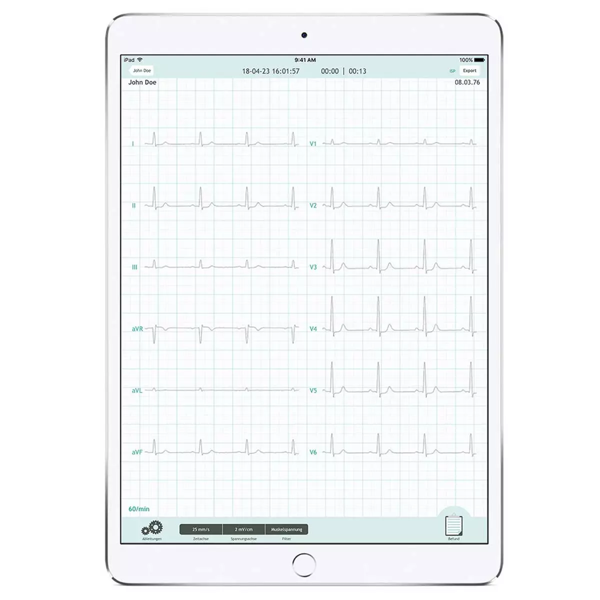 CardioSecur CardioSecur Pro EKG