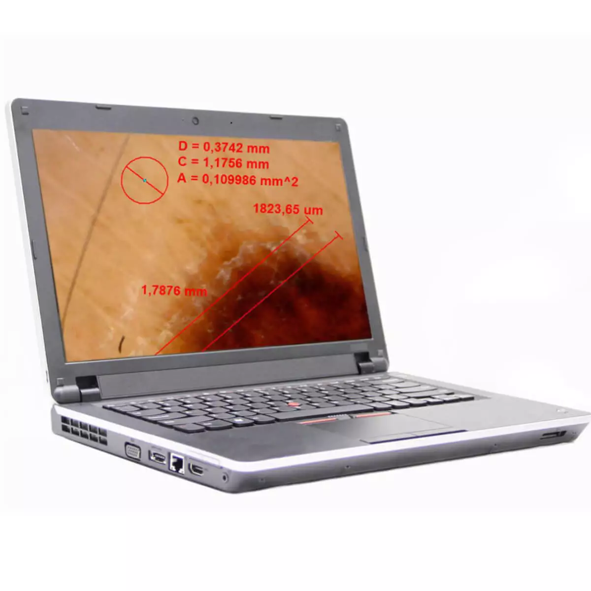 Dino-Lite DermaScope Polarizer Wireless Videodermatoskop
