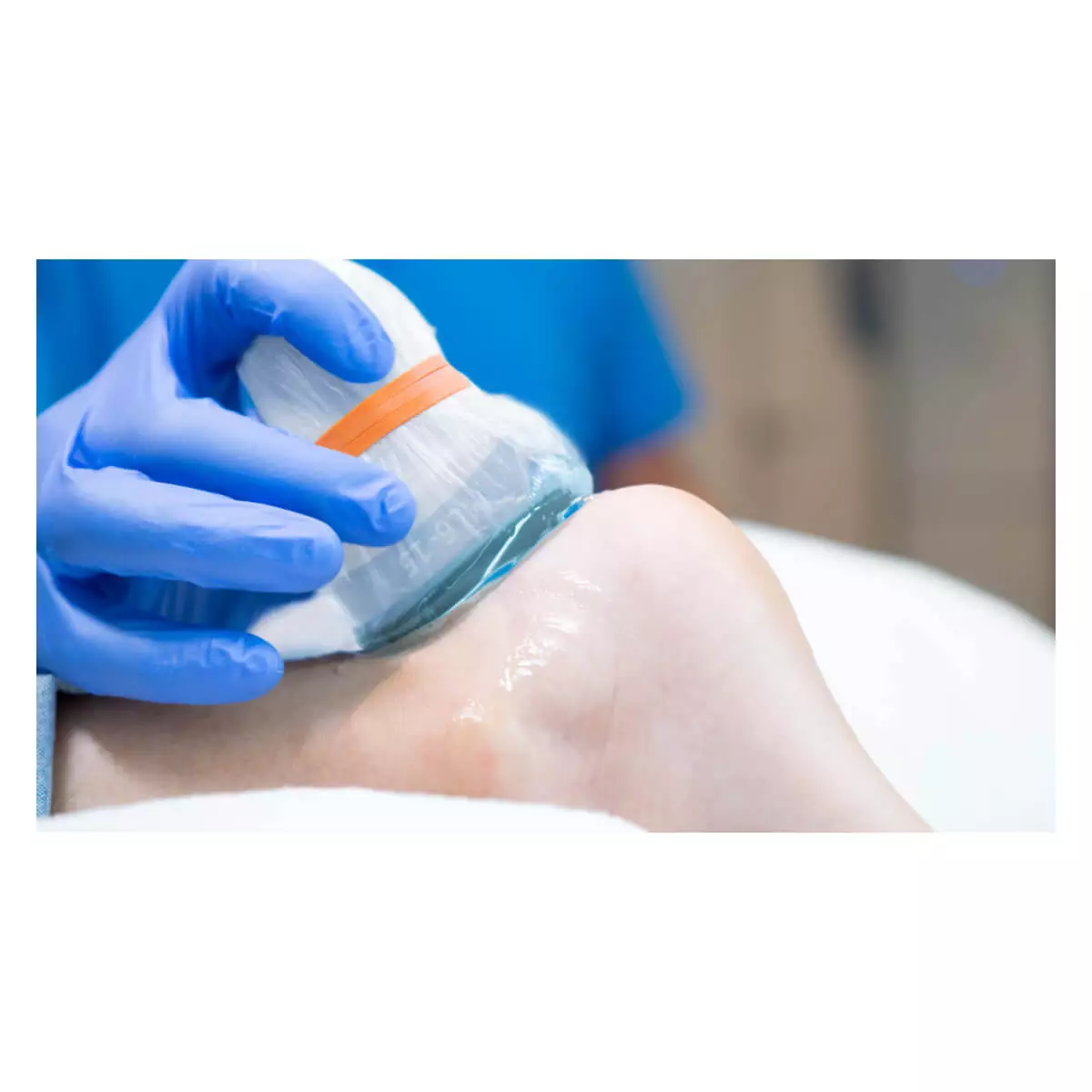 Aison Technologies aiSon FOCUS Gelpads für Ultraschallsonden