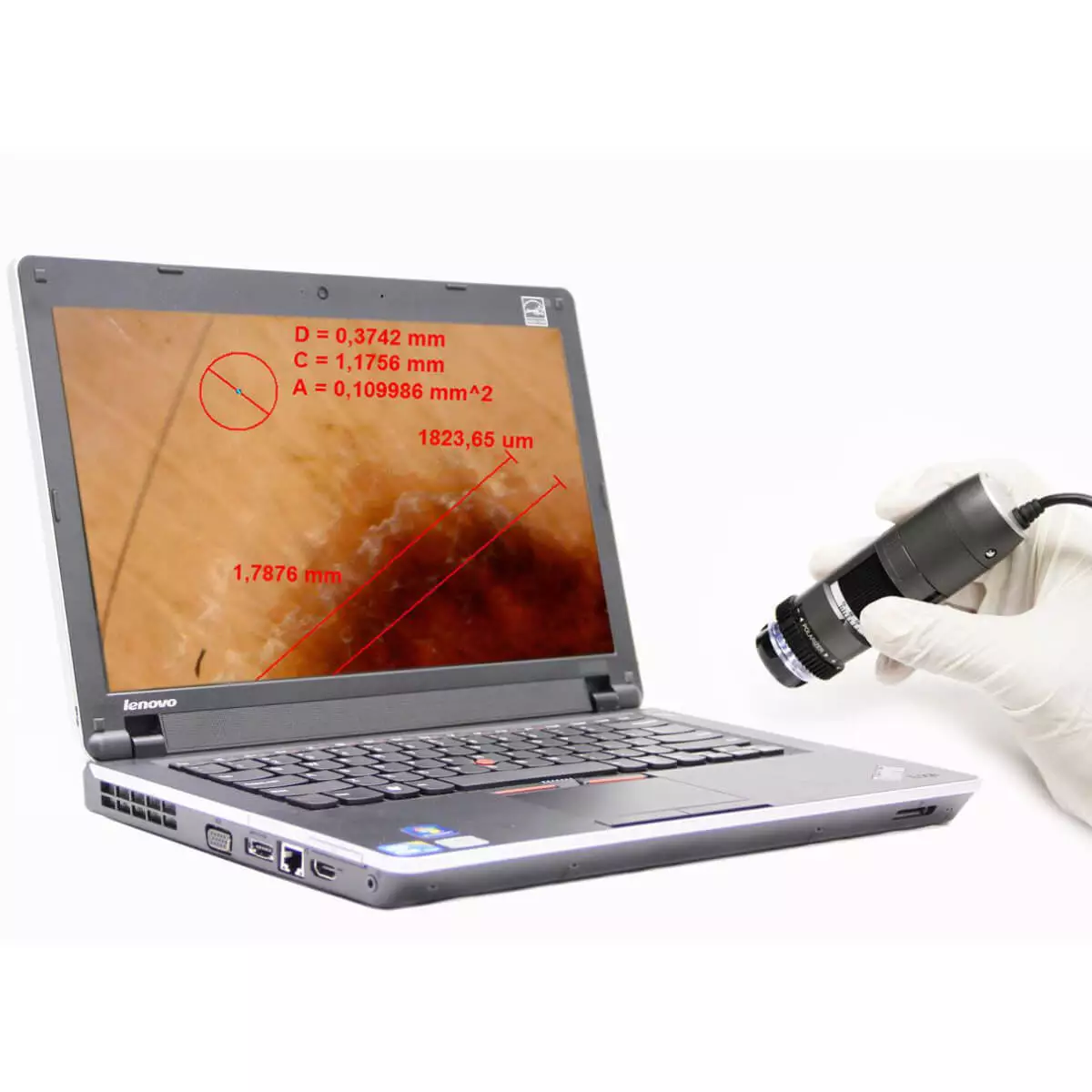 Dino-Lite DermaScope Polarizer HR 200x Videodermatoskop