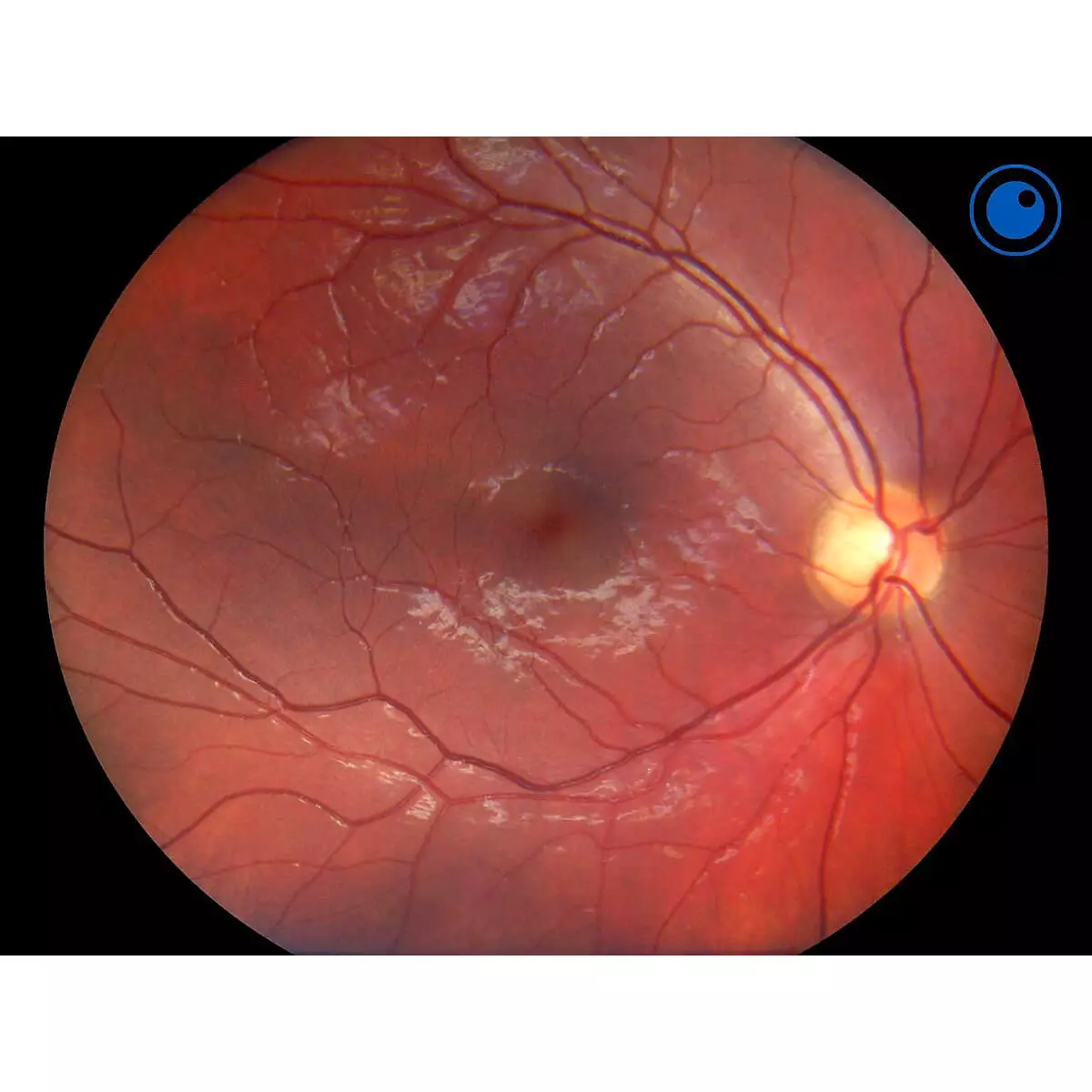Optomed Optomed Aurora IQ Hand-Funduskamera