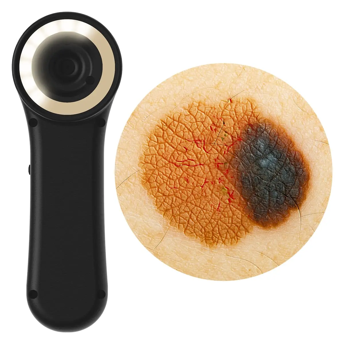 DocCheck Thïngs Digitales Dermatoskop "Scaut®"