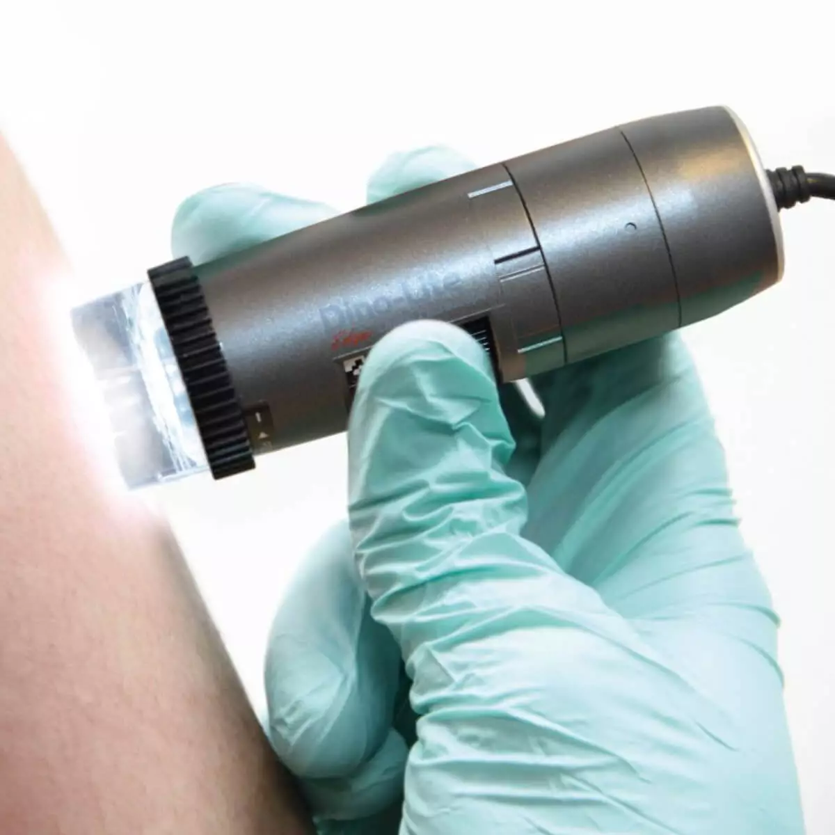 Dino-Lite DermaScope Polarizer HR 200x Videodermatoskop