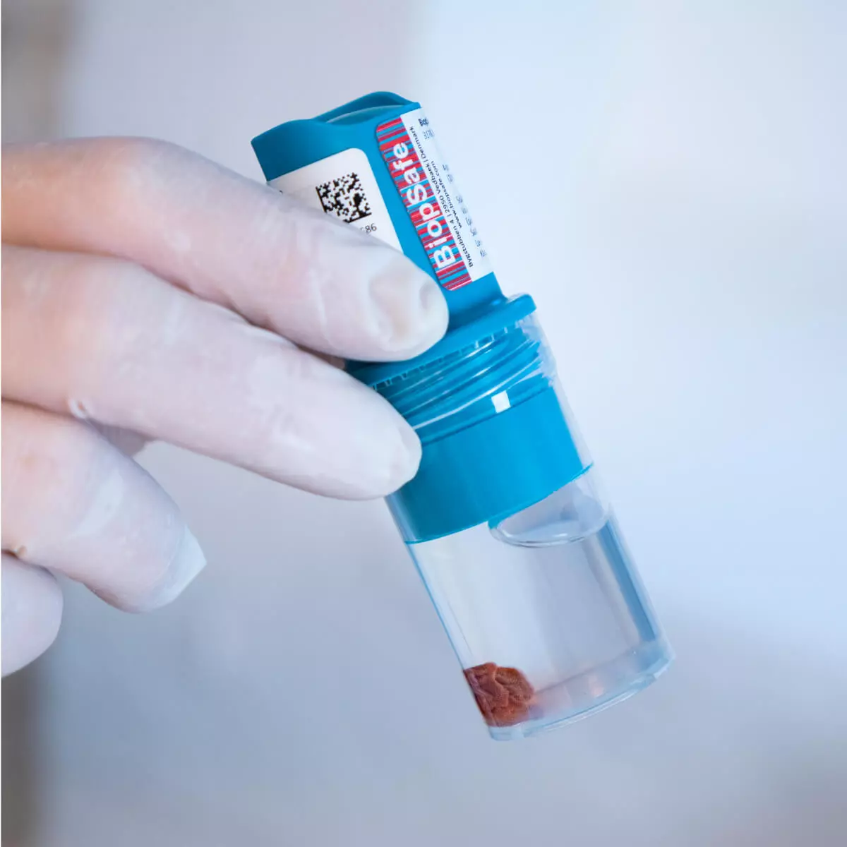 BiopSafe BiopSafe – Probenbehälter für Biopsate