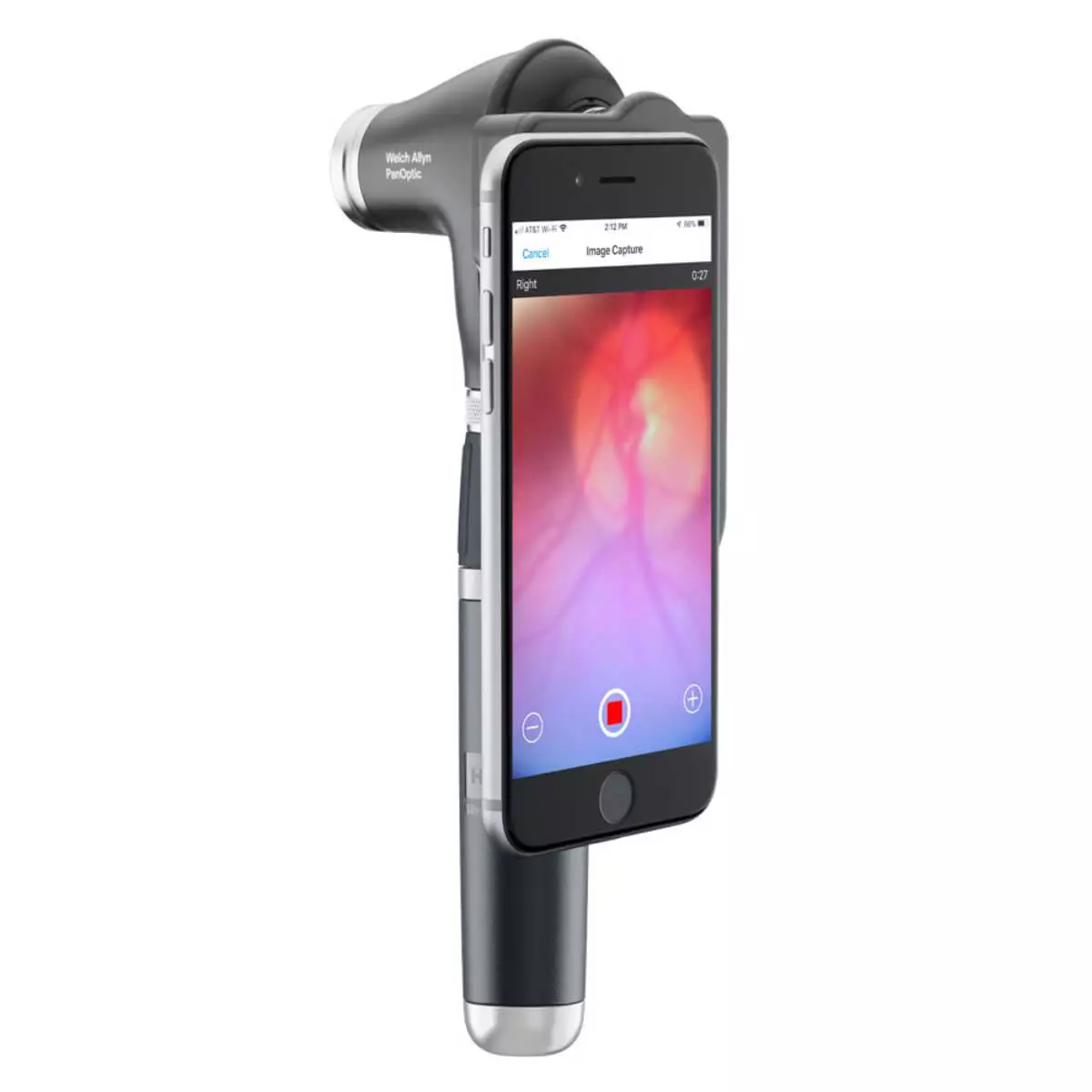 Welch Allyn PanOptic Plus Ophthalmoskop-Kopf mit iExaminer Welch Allyn PanOptic Plus Ophthalmoskop-Kopf mit iExaminer