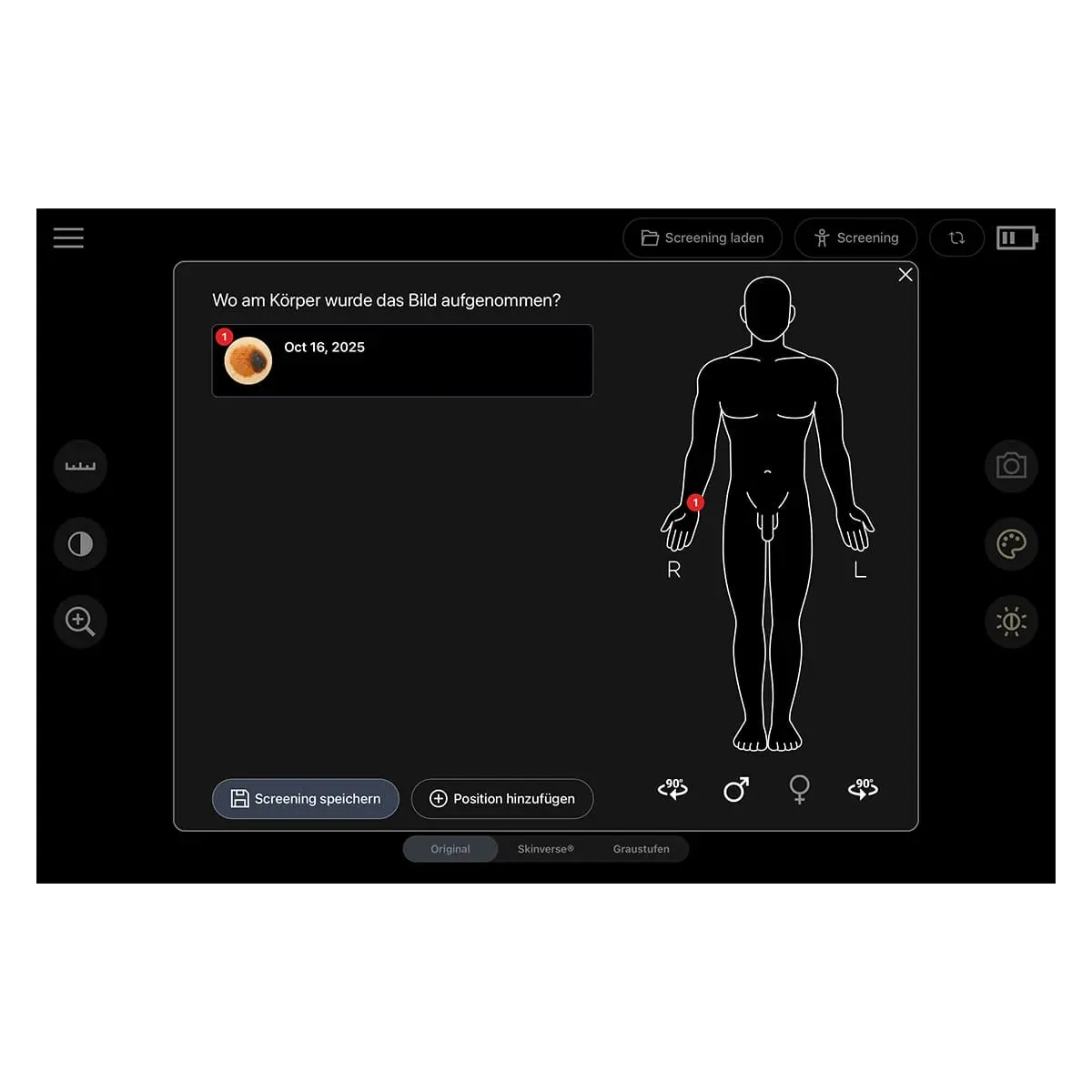 DocCheck Thïngs Digitales Dermatoskop "Scaut®"