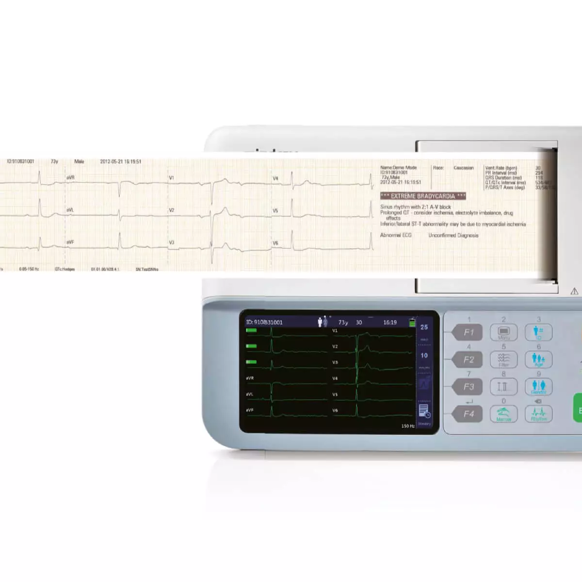 Mindray BeneHeart R3 EKG