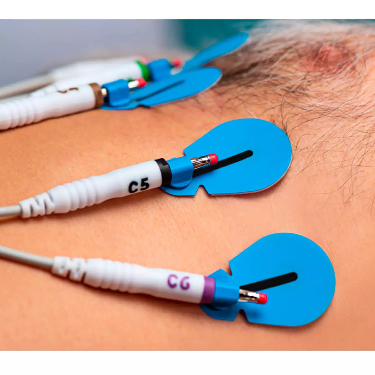Ambu BlueSensor SU-00-A/60 Einweg-EKG-Elektroden