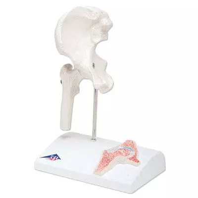 3B Scientific Mini-Modell Hüftgelenk