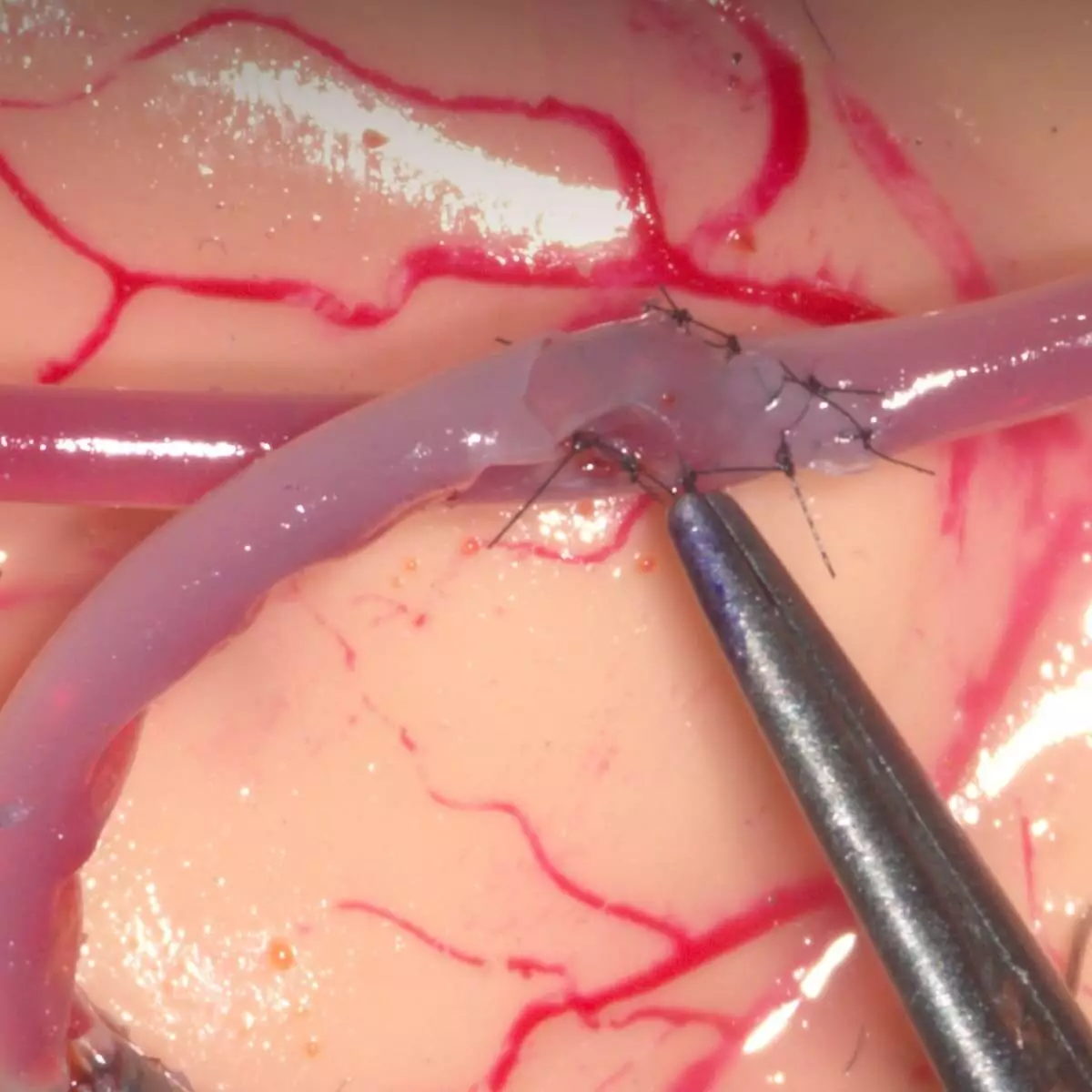 UpSurgeOn Mycro Trainingssystem für mikrovaskuläre Anastomosen & Mikronähte