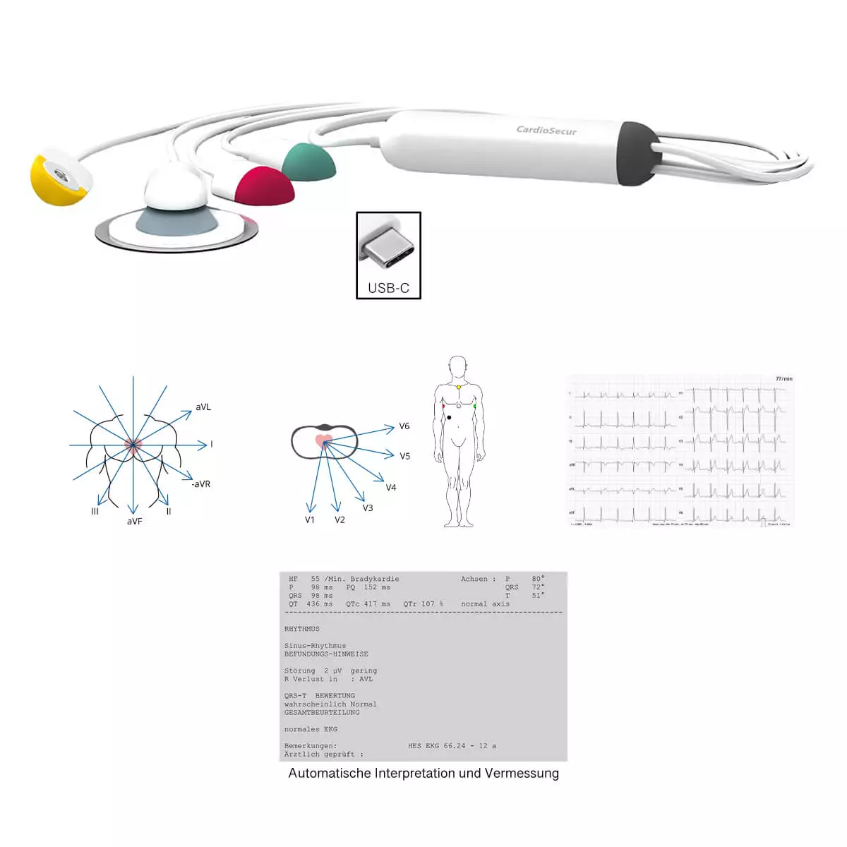 CardioSecur CardioSecur Pro EKG CardioSecur CardioSecur Pro EKG