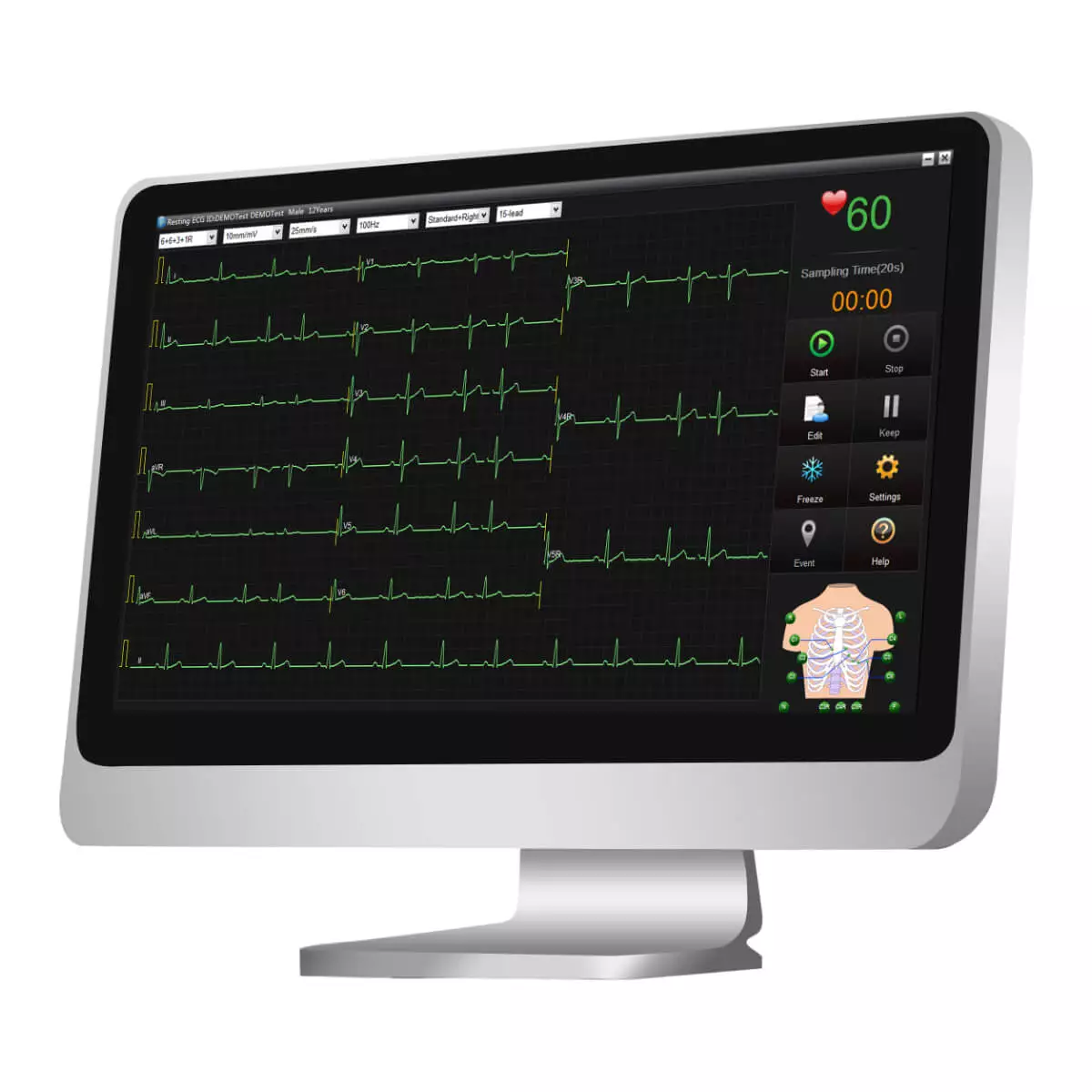 EDAN SE-1515 EKG Datenmanagement-Software
