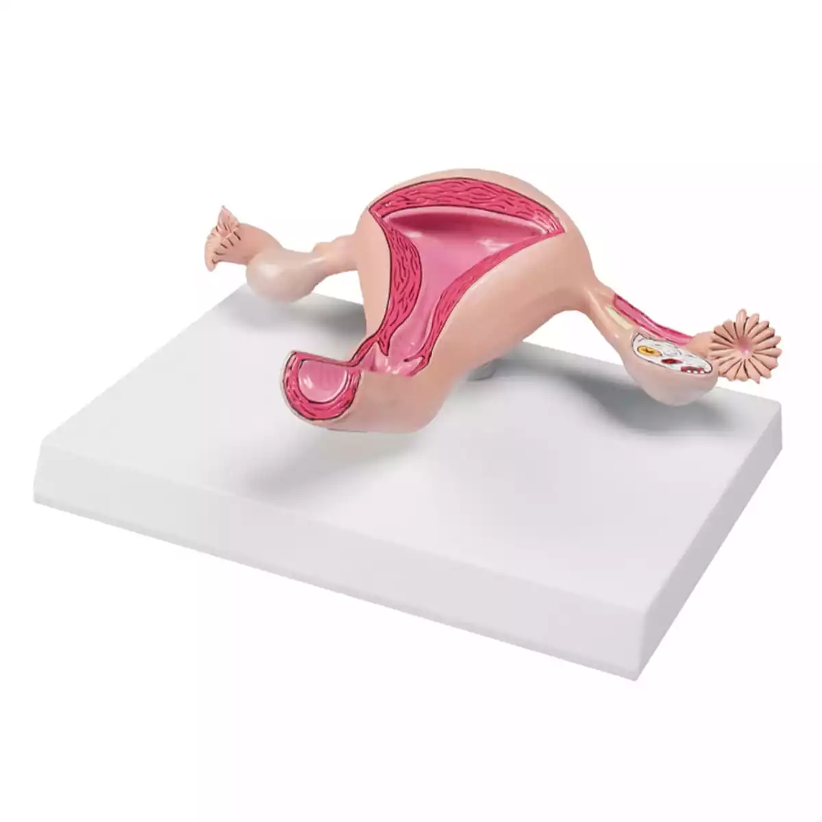 Erler-Zimmer Uterusmodell