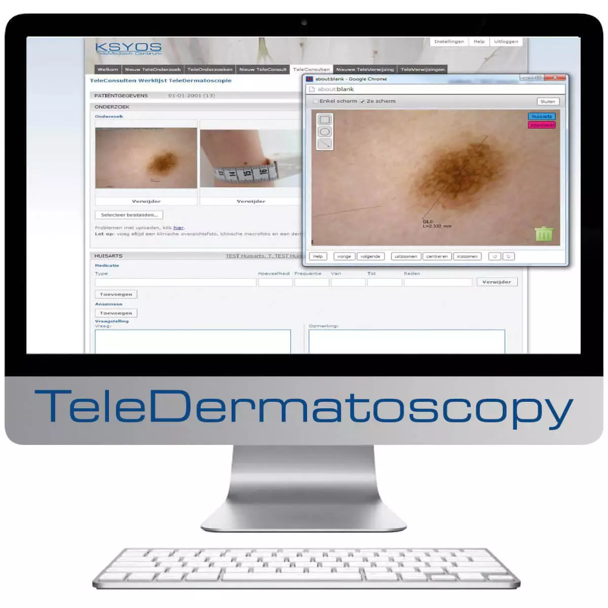 Dino-Lite DermaScope Polarizer Wireless Videodermatoskop