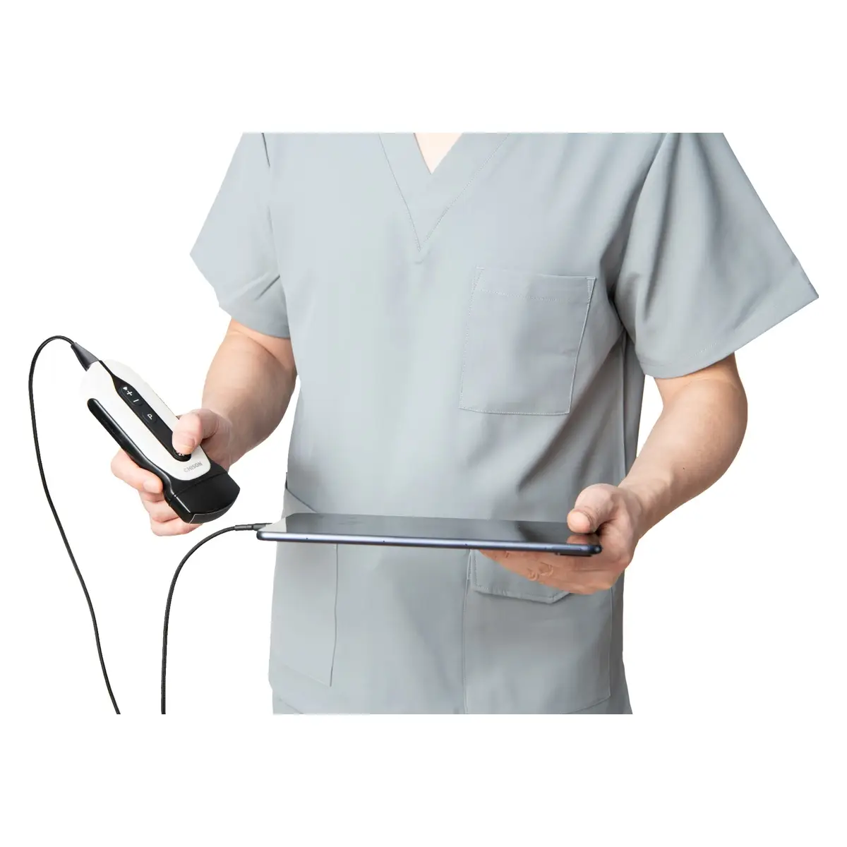 CHISON SonoEye mobiles Ultraschallsystem CHISON SonoEye mobiles Ultraschallsystem