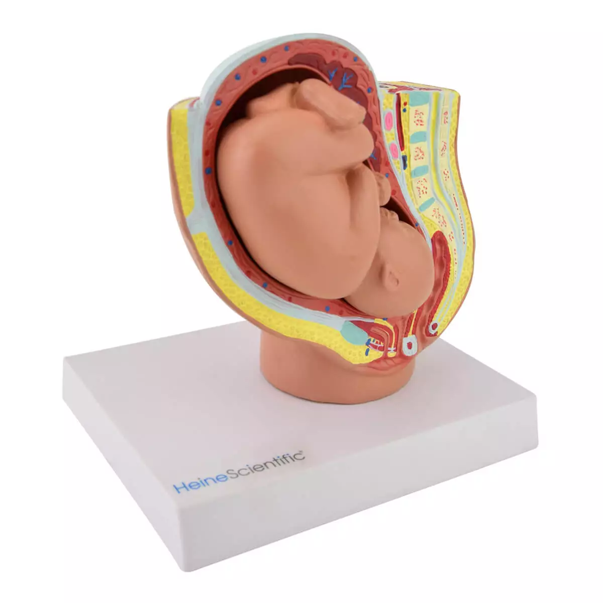 HeineScientific Miniatur-Modell Becken mit Fötus