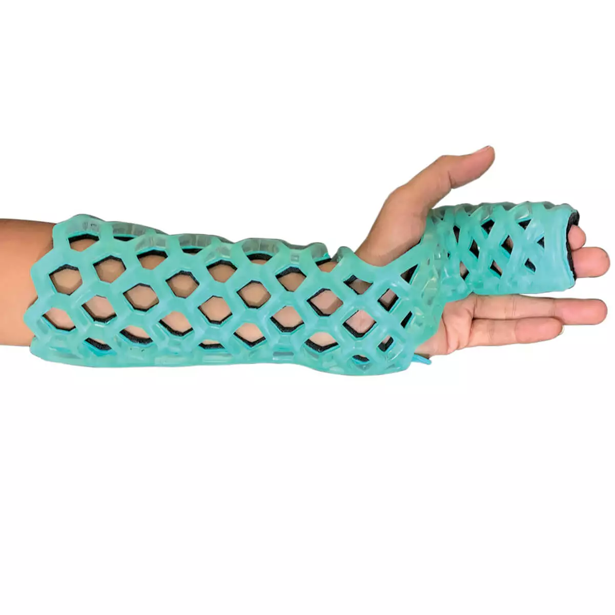 OrthoHeal FlexiOH Immobilizer Orthese – Radial Gutter