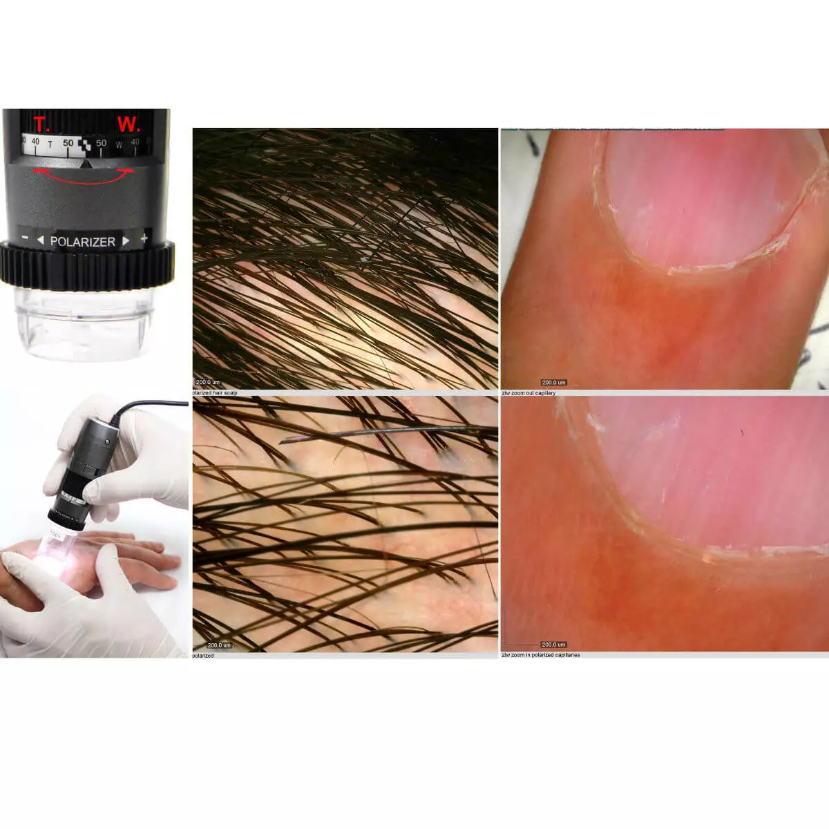 Dino-Lite DermaScope Polarizer Wireless Videodermatoskop