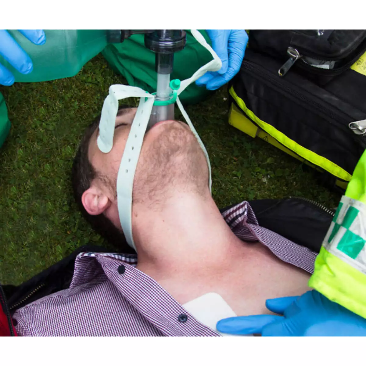 Intersurgical i-gel O2 Resus Larynxmaske im Set